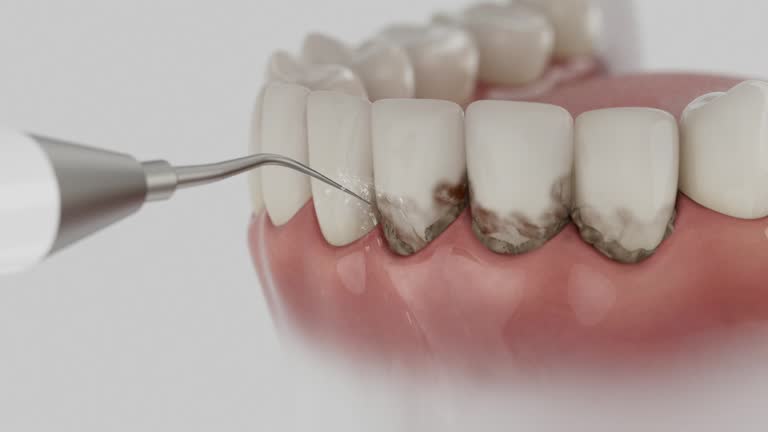 Reliable Emergency Dentist contractor in Senatobia, MS by Smile Center Dentistry